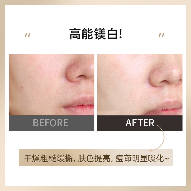 Tinh Chất VC Dưỡng Trắng Da Dr.Ci:Labo 377 18g