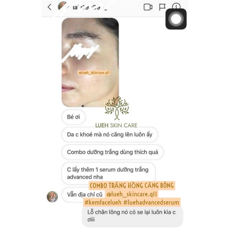 Advanced Serum LUEH - Serum Lô Hội dưỡng ẩm, căng bóng, trắng hồng, thấm nhanh_Whitening Repair Night Serum