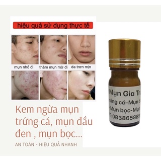 Kem ngừa mụn trứng cá , mụn đầu đen , mụn bọc handmade hiệu quả nhanh lọ 10g (Đát luôn mới)