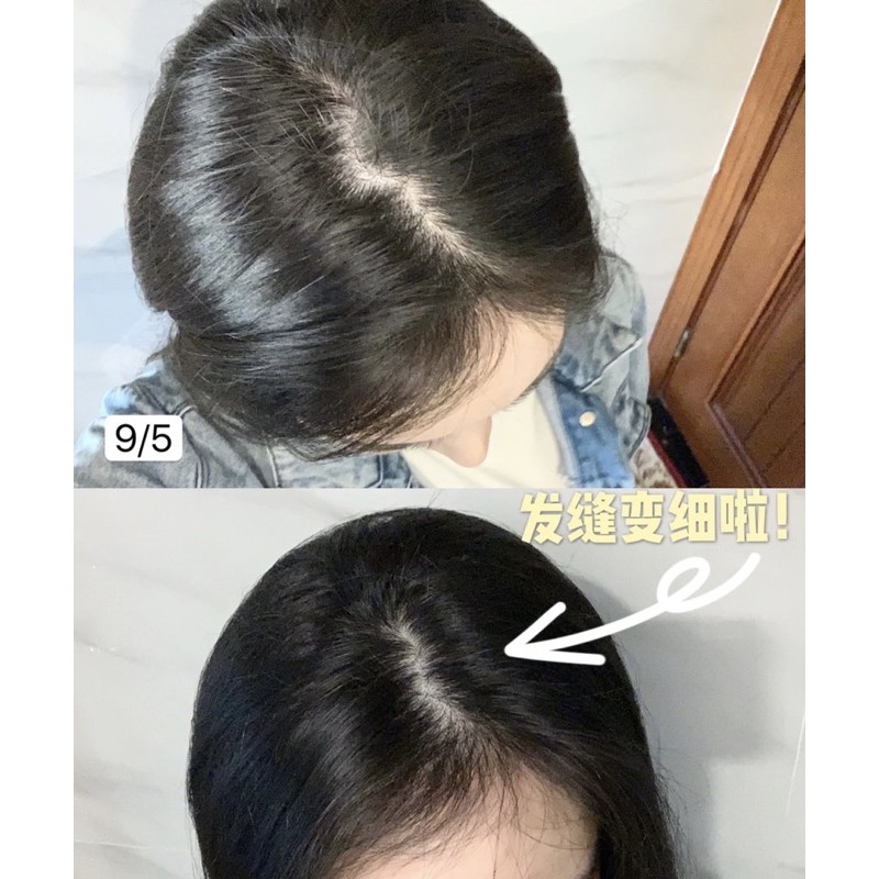 Nature Bounty Hair Skin Nail Gummies | BigBuy360 - bigbuy360.vn