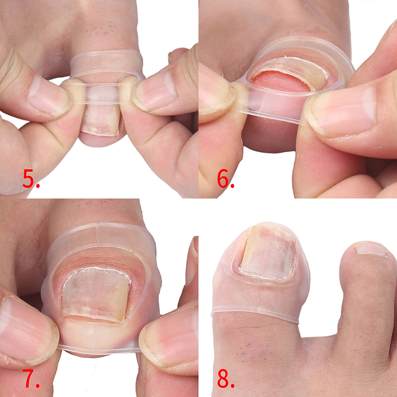 (Hàng Mới) Dụng Cụ Sửa Chữa Móng Tay Bằng Silicone