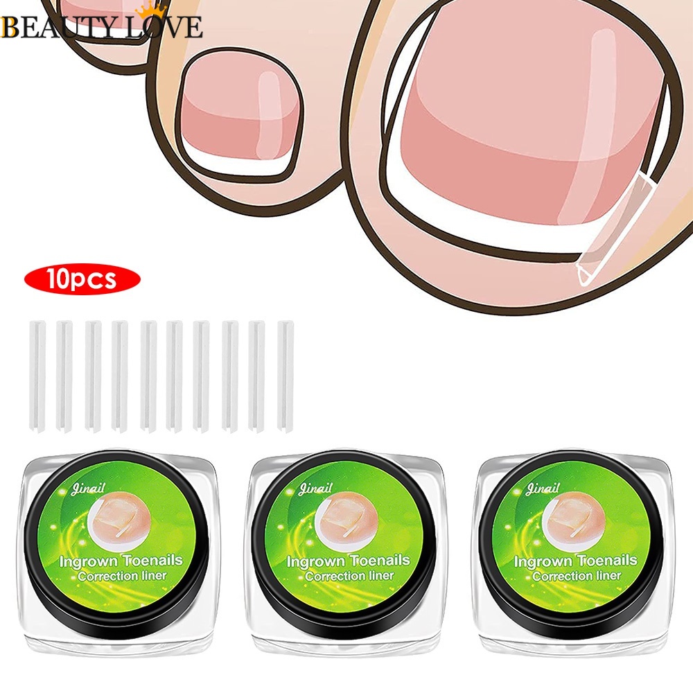 Set 10 Dụng Cụ Chỉnh Sửa Móng Chân / Móng Chân Siêu Mỏng Dùng Một Lần