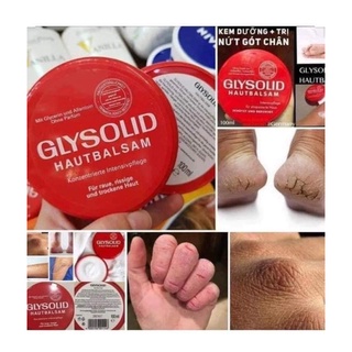 kem chống nẻ Glysolid Hautbalsam Đức