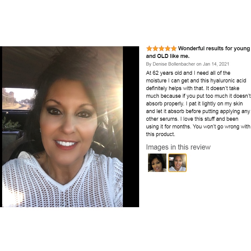 Tinh chất Hyaluronic Acid cấp ẩm căng da thu nhỏ lỗ chân lông cho da dầu khô nhạy cảm