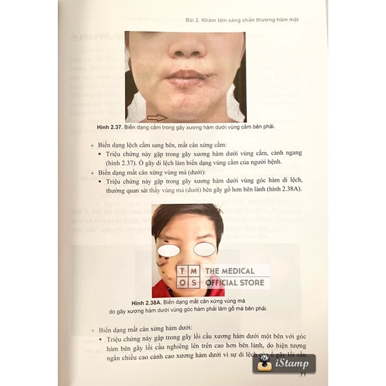 Sách - Chấn Thương Hàm Mặt Tmos