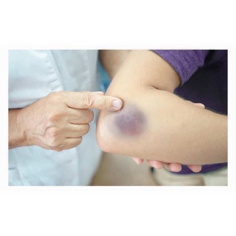 KEM TAN BẦM ARNIGEL PHÁP 45g