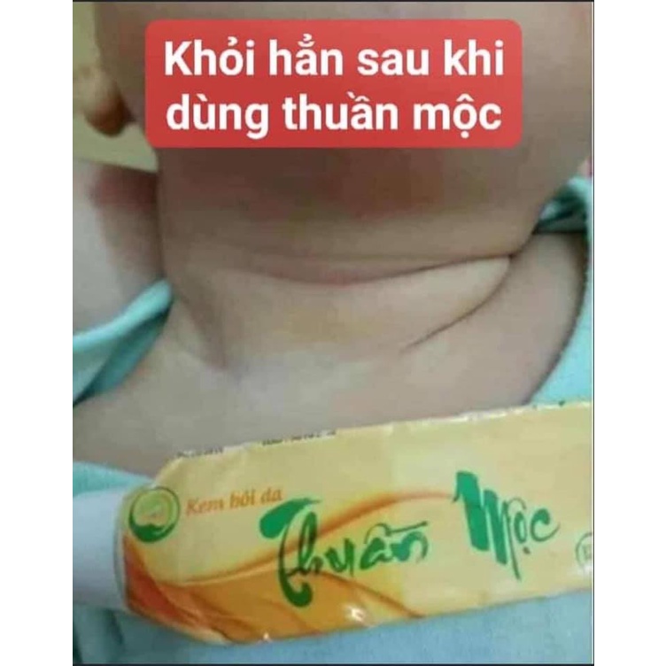 Kem bôi da Thuần Mộc 16 g Mẫu Mới Nhất