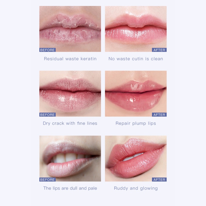 Kem Tẩy Tế Bào Chết Môi Collagen Dưỡng Ẩm Cho Đôi Môi Đầy Đặn