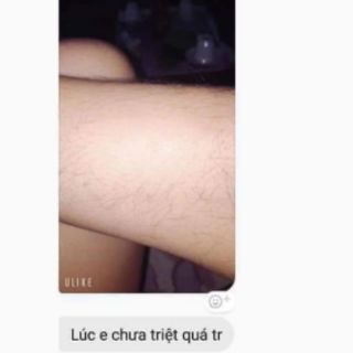 Combo triệt lông vĩnh viễn