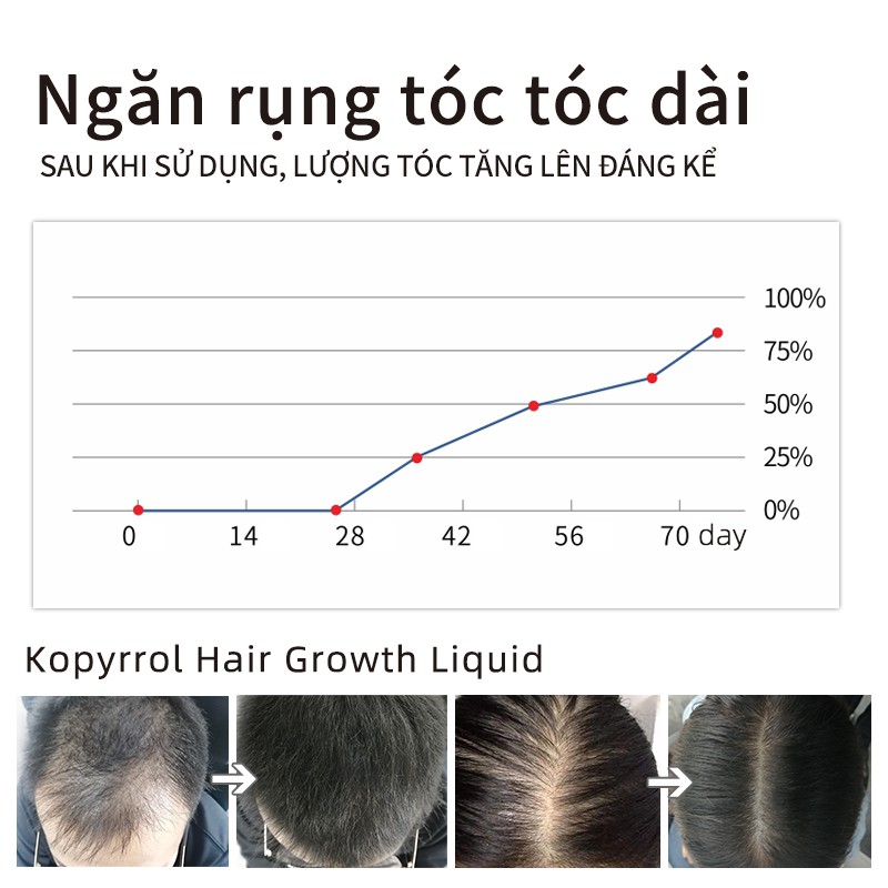 KOPYRROL Nhanh KíCh ThíCh MọC TóC Serum 60g