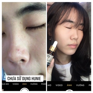 Serum Hunie