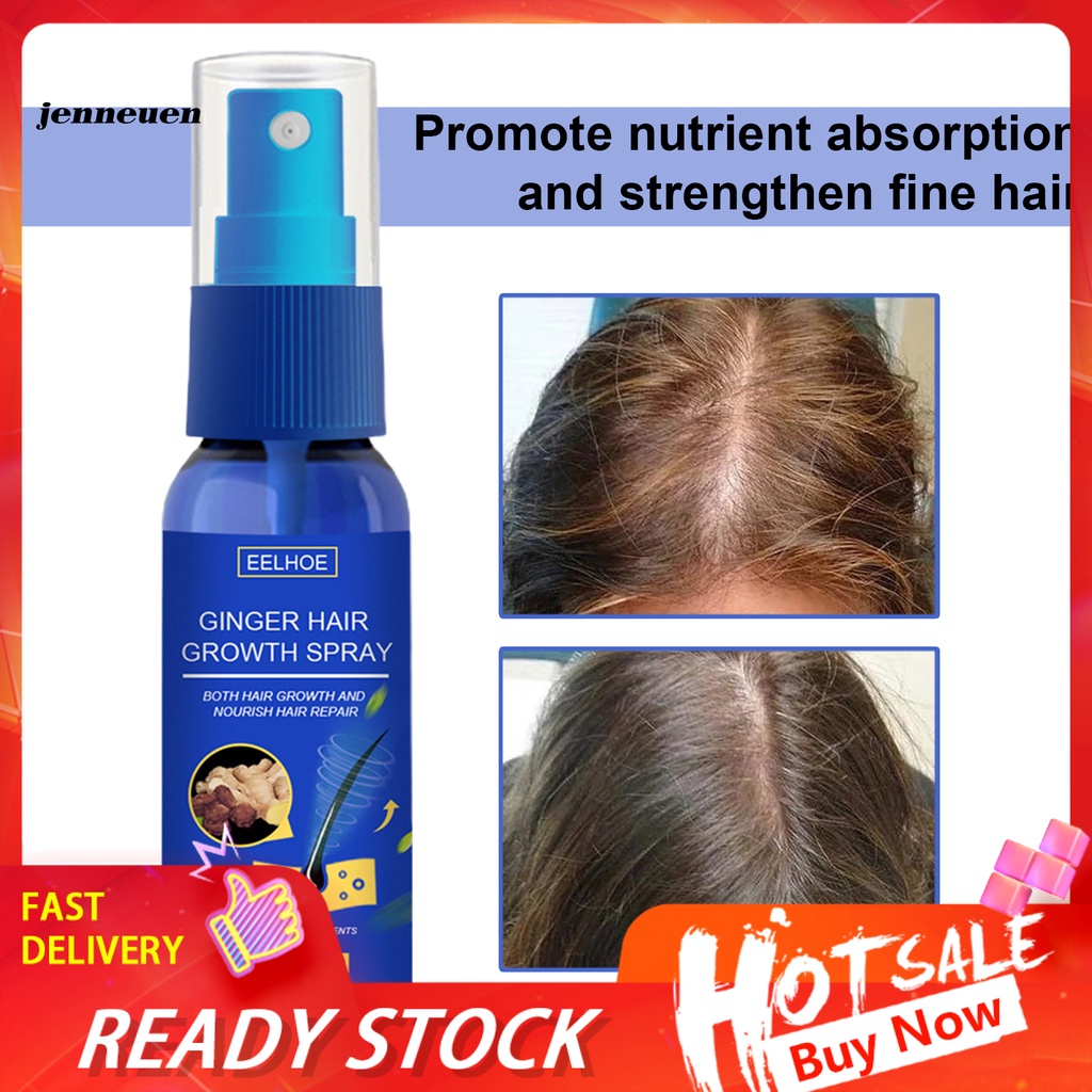 [Hàng mới về] Chai Xịt Kích Thích Mọc Tóc Chiết Xuất Từ Gừng