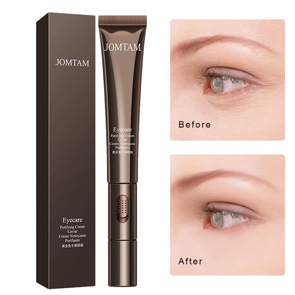 Máy Massage Mắt Kèm Kem Dưỡng Mắt JOMTAM 2in1 - Giảm Quầng Thâm, Nâng Da Chống Lão Hoá | BigBuy360 - bigbuy360.vn