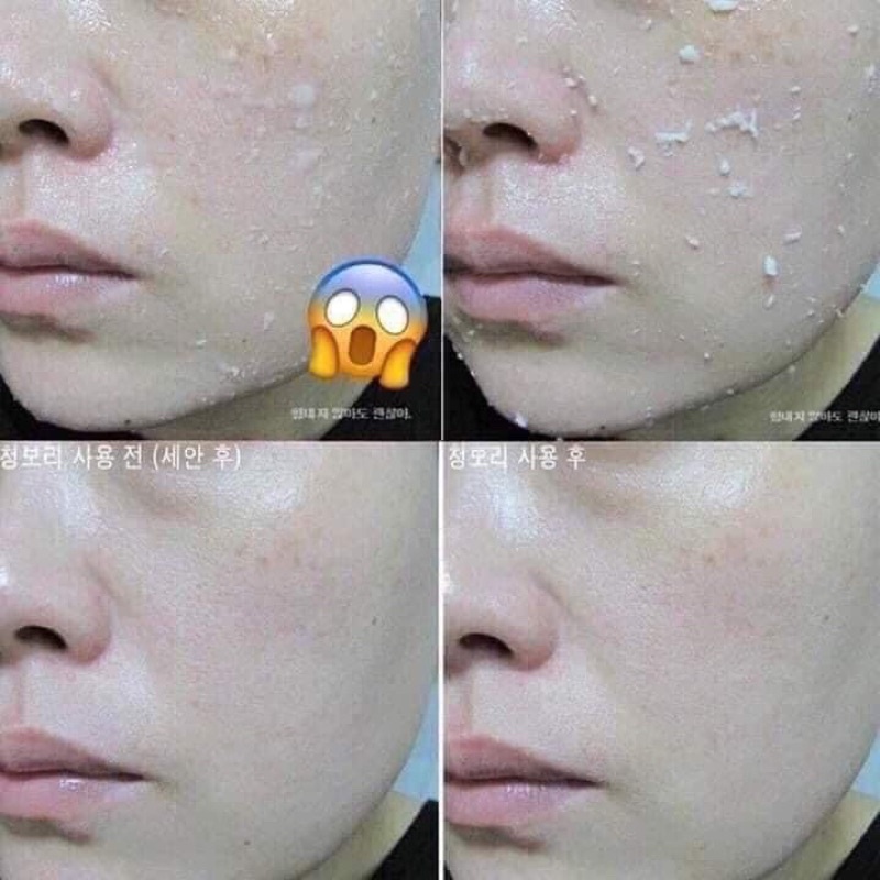 Tẩy da chết Arrahan