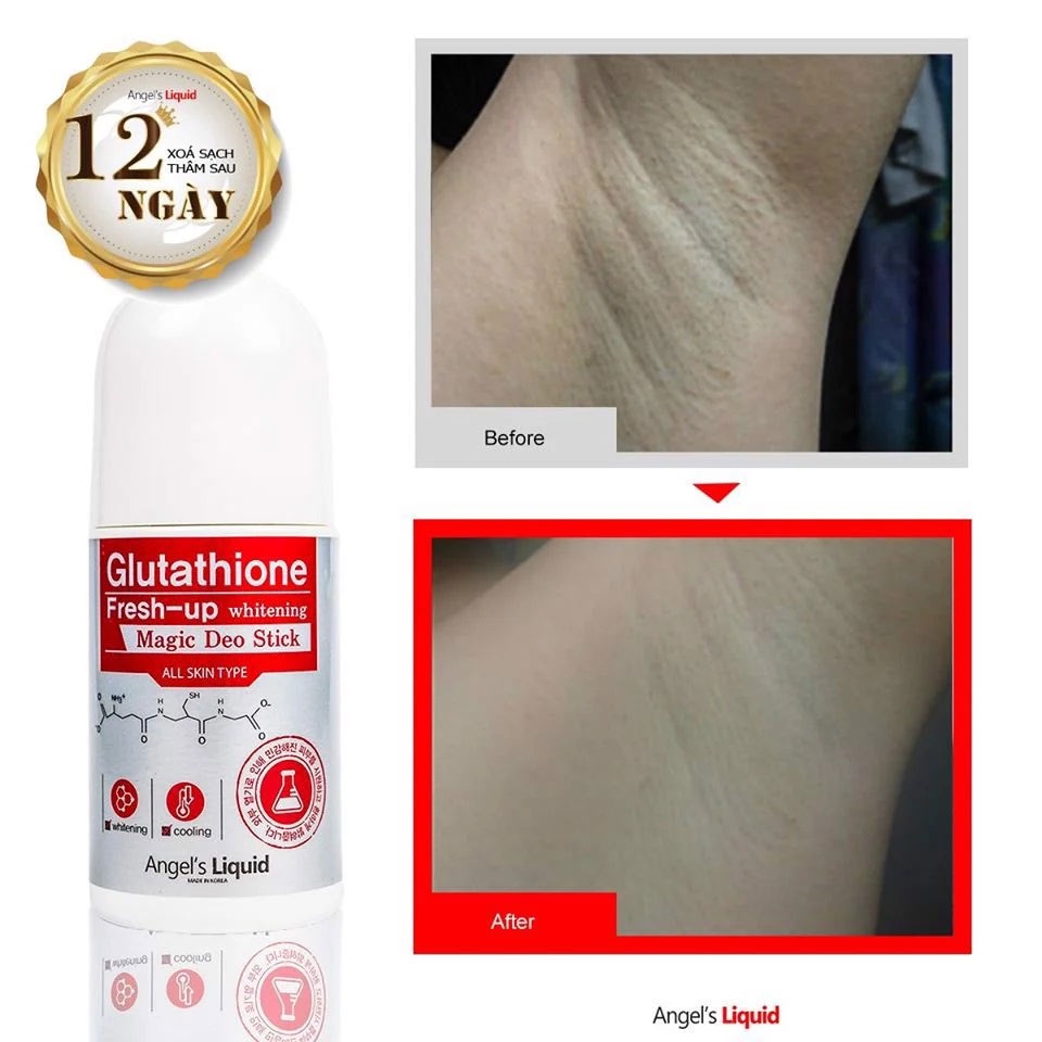 Lăn Khử Mùi Angel's Liquid Glutathione Fresh-Up Whitening Magic Deo Stick 60ml