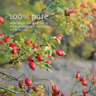 Dầu Rose Hip Seed Oil