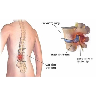 dược liệu diệu phương 500ml