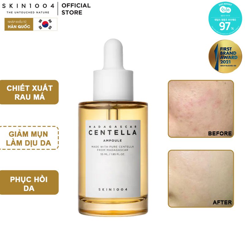 Tinh Chất Rau Má Hỗ Trợ Giảm Mụn, Phục Hồi Da Skin1004 Madagascar Centella Ampoule
