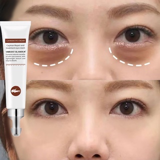 Kem Dưỡng Da Mắt Hailicare Xóa Mờ Quầng Thâm / Bọng Mắt / Nếp Nhăn Hiệu Quả