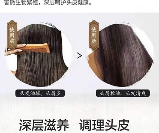 Dầu gội hỗ trợ hết gầu, nấm da đầu hàng nội địa trung