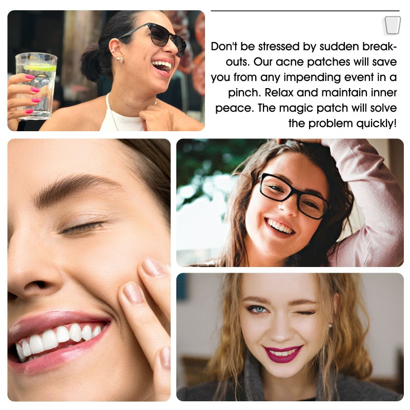 Set 20 Miếng Dán Mụn Trứng Cá YOUYO Giúp Hấp Thụ Mụn Hiệu Quả