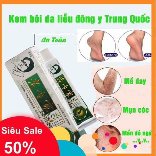 Kem nẻ ĐÔNG Y - chuyên Nứt Gót Chân, Á Sừng, Ngứa Da, Nứt Nẻ Chân Tay, vết cắn côn trùng