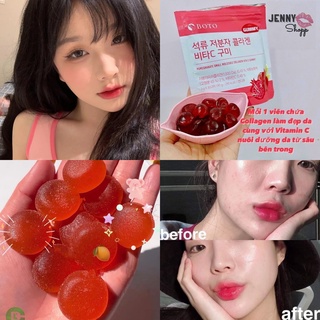 Kẹo Dẻo Gummy Collagen Lựu Vitamin C Boto Gummy Gói 30 Viên