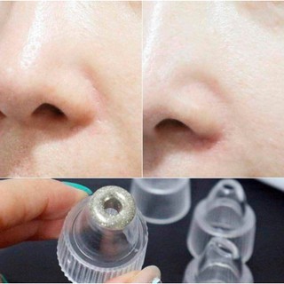 [ HÀNG CAO CẤP ] Máy hút mụn đầu đen mini cầm tay