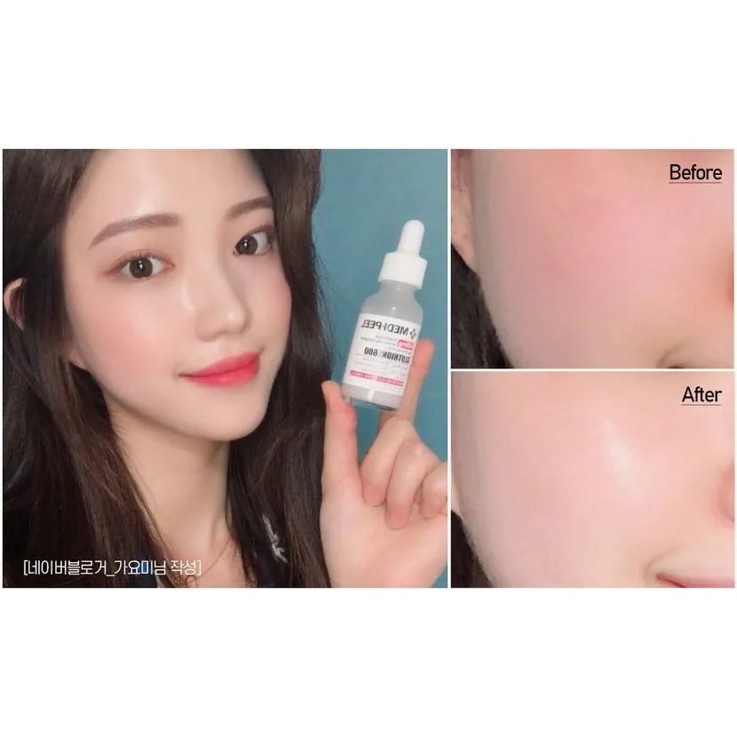 Tinh chất dưỡng trắng Medi Peel Bio Intense Glutathione 600 White Ampoule Serum Ngừa Nám, Trắng Da Mẫu mới- HONGS BEAUTY