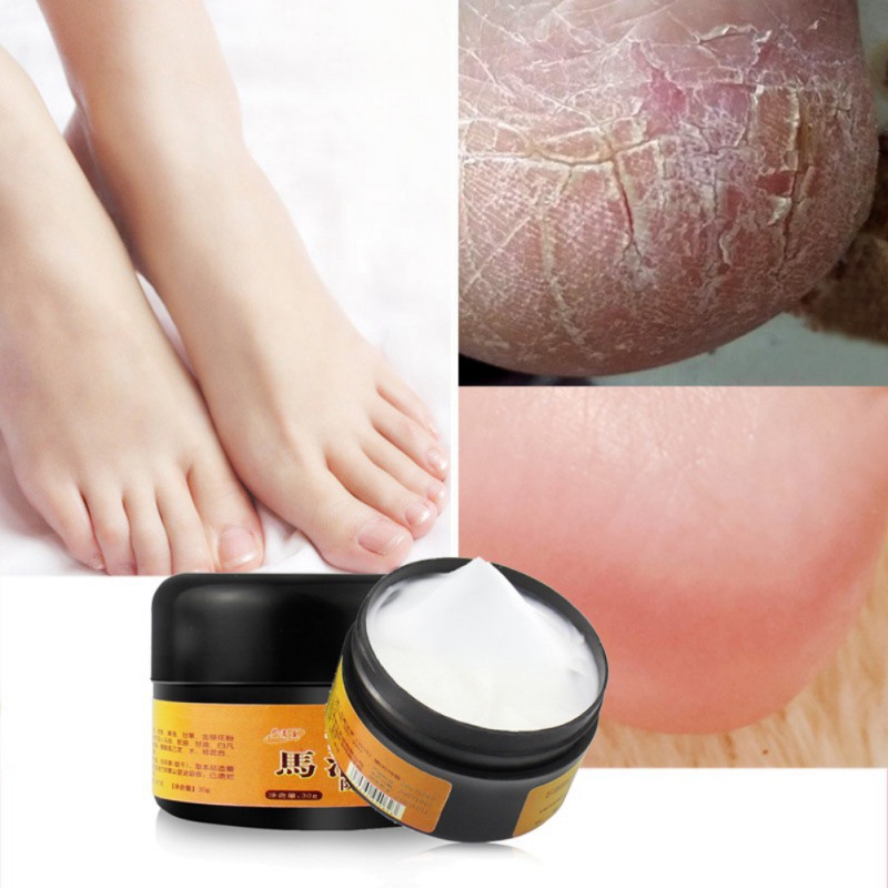 Kem dầu ngựa dưỡng da chân chống nứt nẻ và thô ráp