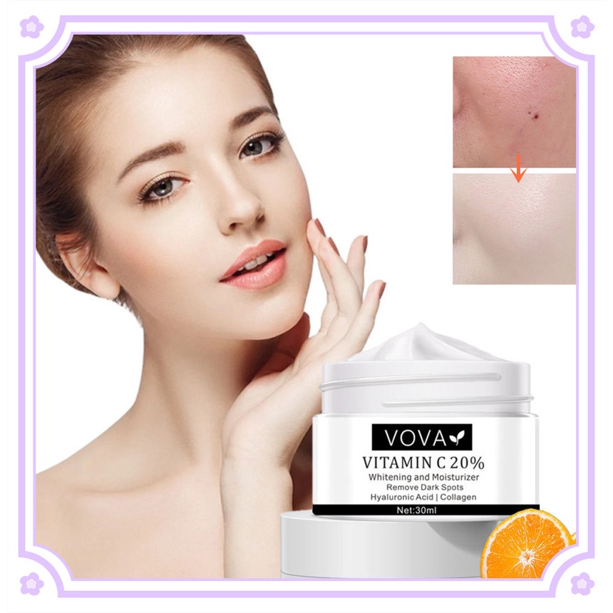 Vova 30Ml Vitamin C Làm Trắng Da Tàn Nhang Kem Phai Màu Freckls Loại Bỏ Các Vết Thâm Đen Ức Chế Melanin Dưỡng Ẩm Làm Sáng Da Ban Ngày