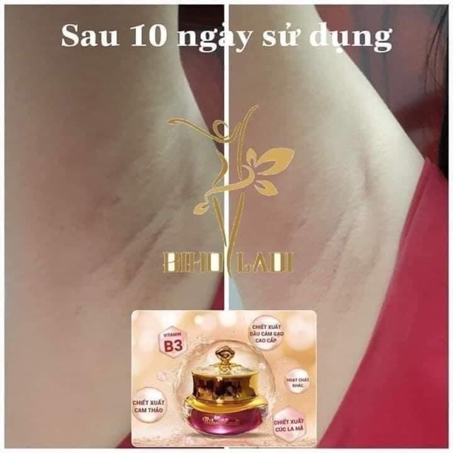 [Mua 1 tặng 1] Siêu Dưỡng thâm 5S BIHO LADI | BigBuy360 - bigbuy360.vn