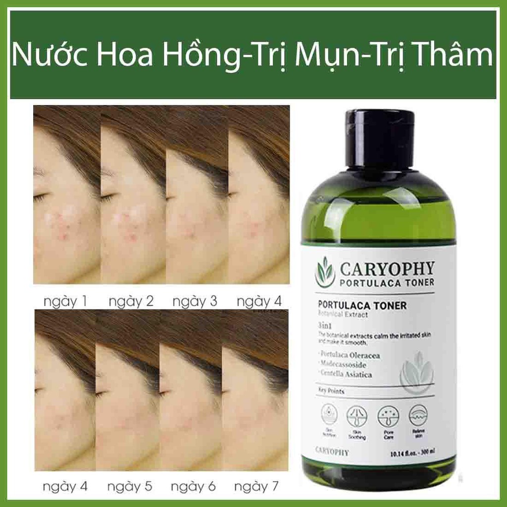 Bộ 3 sản phẩm giảm mụn thâm Caryophy Portulaca ( Sữa Rửa Mặt 150ml + Toner 300ml + Serum 10ml )