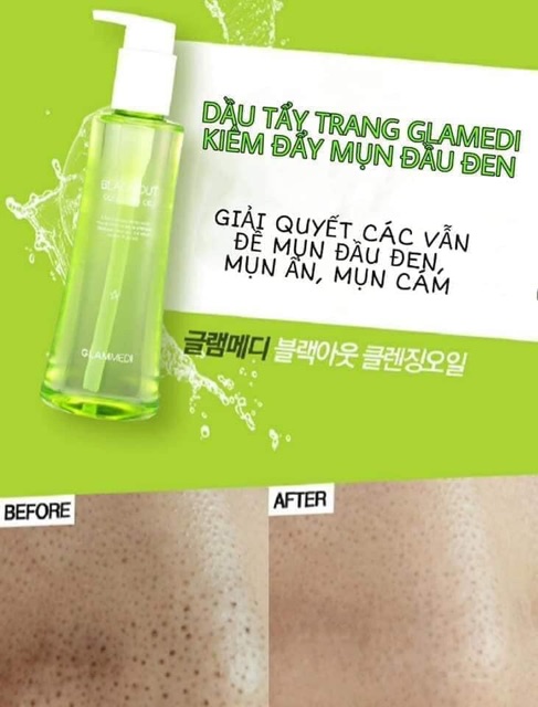 Dầu tẩy trang KÍCH Ủ MỤN ĐẦU ĐEN 3 in1 Glammedi Black Out Cleansing Oil