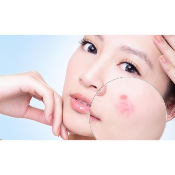 ✅ (HÀNG CHUẨN AUTHENTIC) Kem Gỉam Mụn Chuyên Biệt La Roche Posay Effaclar A.I | BigBuy360 - bigbuy360.vn