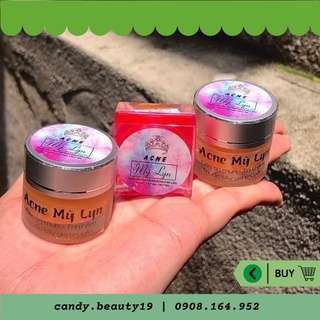 Ance Mụn Mỹ Lyn 5gr -10gr