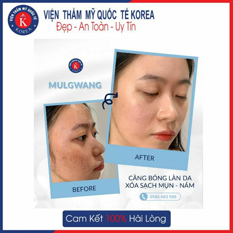 - MULWANG TÁI TẠO nền da khoẻ mạnh