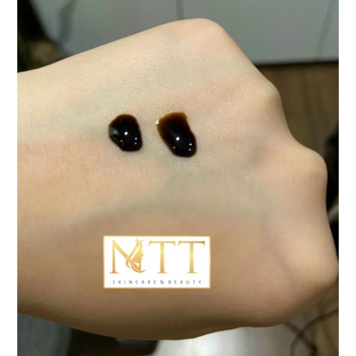 Serum mụn NTT