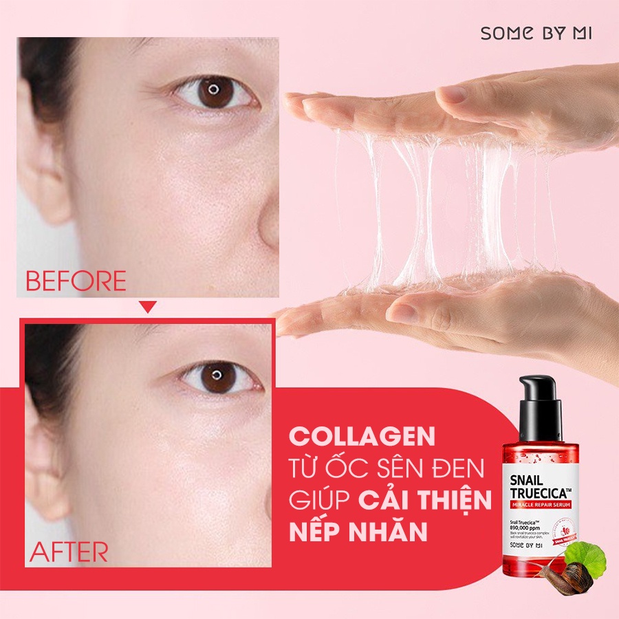 [Mã FMCGMALL -8% đơn 250k] Tinh chất ốc sên đen giảm sẹo lõm sẹo mụn Some By Mi Snail Truecica Miracle Serum 50ml