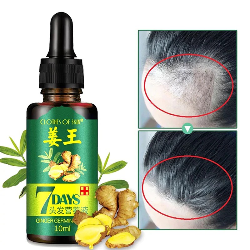 (Hàng Mới Về) Serum Kích Thích Mọc Tóc Và Chăm Sóc Sức Khỏe