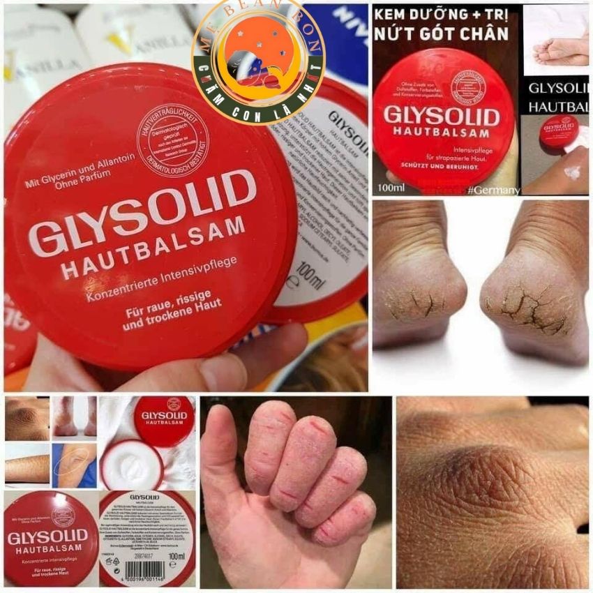 Kem Nẻ Glysolid 100 gam, Kem Nứt Gót Chân Glysolid chuẩn Đức