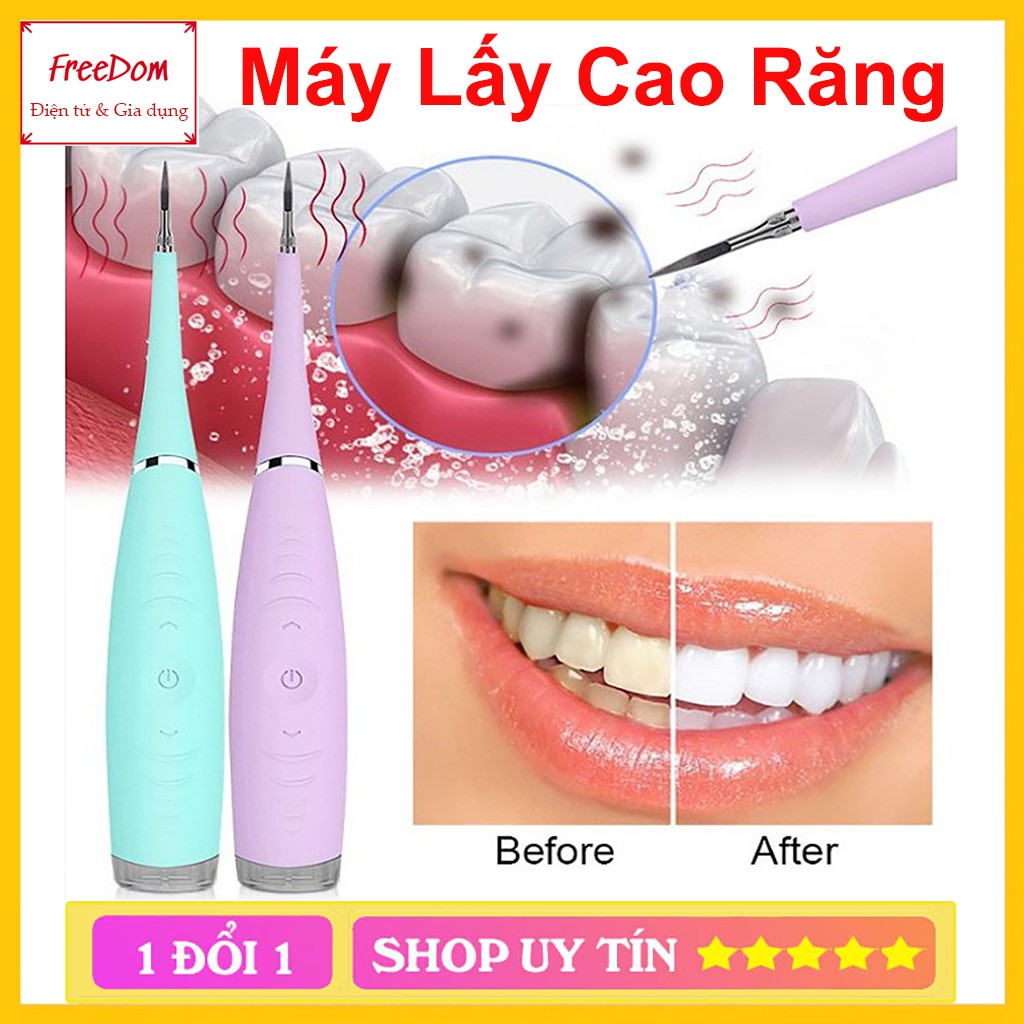 Máy Lấy Cao Răng Cầm Tay Mini 3 Chế Độ Rung Loại Sạch Mảng Bám Cao Răng Vết Ố Cứng Đầu Nhất - An Toàn Tiện Lợi