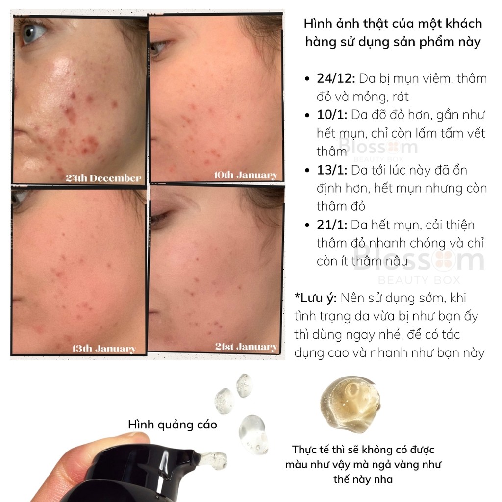 Kem dưỡng phục hồi da mụn, mờ thâm C-50 Blemish Night Treatment The Inkey List