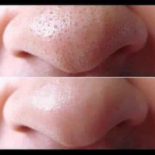 Mặt nạ good bye blackhead ciracle
