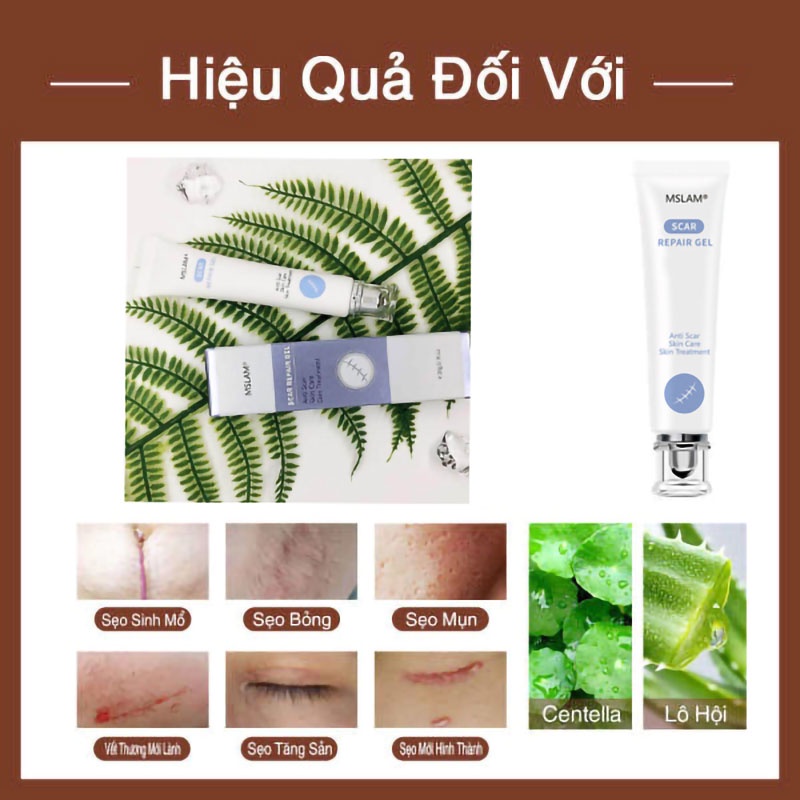 Kem che sẹo Giảm bỏng và bỏng nước Vết thương phẫu thuật v.v.mờ sẹo thâm mụn,mờ thâm ,khổi phục da,Kem chuyên xóa sẹo lồi lâu năm.