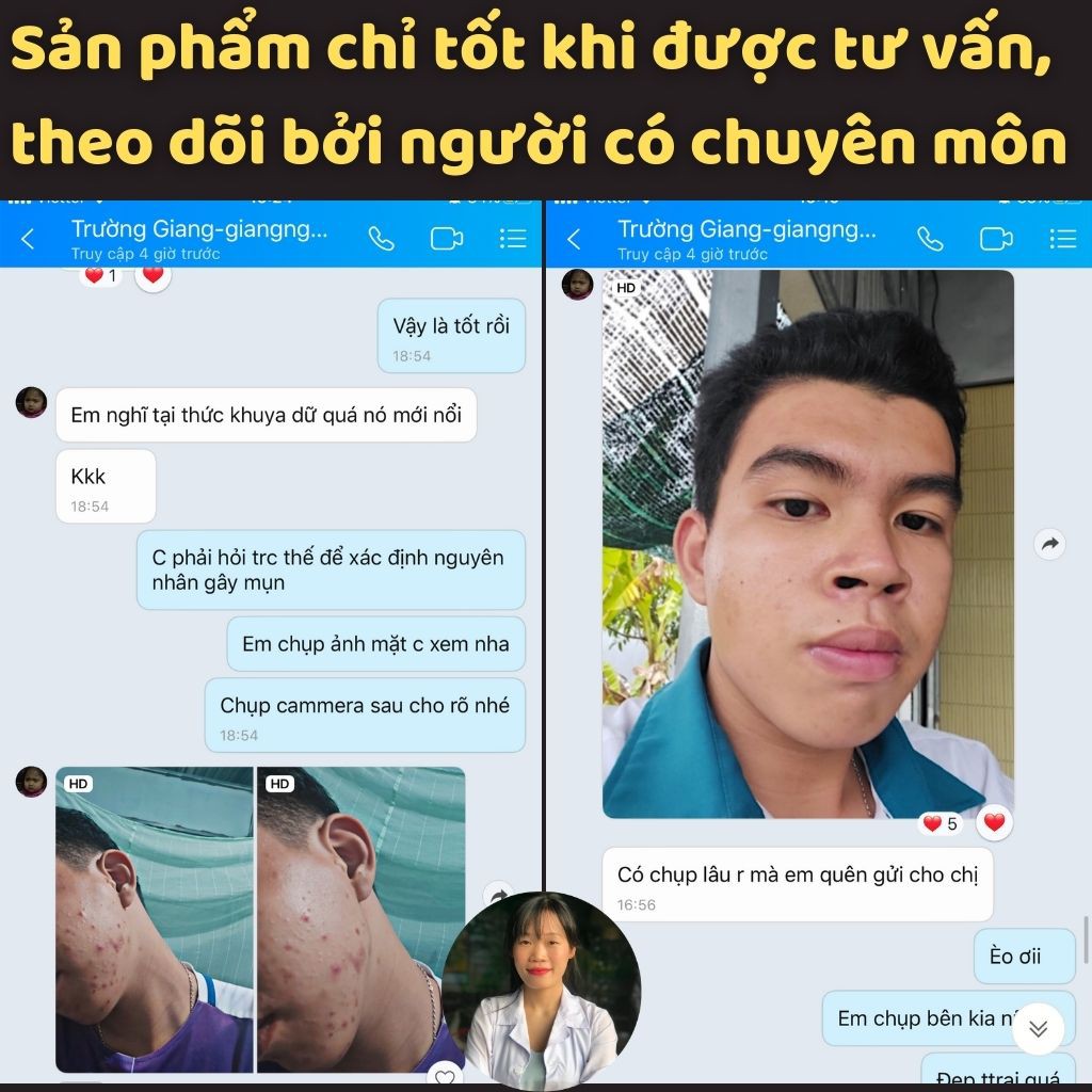 Serum ngừa mụn Lá Nam Acnes an toàn, tiết kiệm, không gây bong da, không xót rát, không sưng đỏ, đồng hành đến khi khỏi | BigBuy360 - bigbuy360.vn