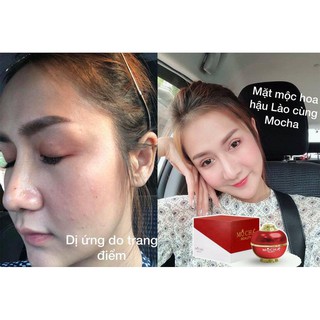 Kem nhạy cảm trắng da mocha