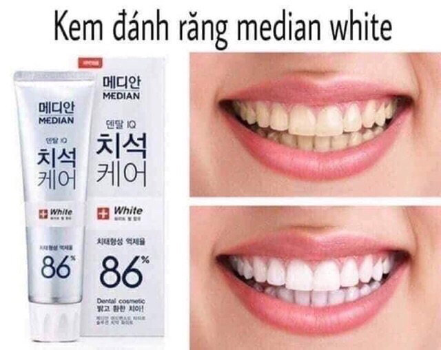 Kem đánh răng Hàn Quốc Median dental IQ 93%