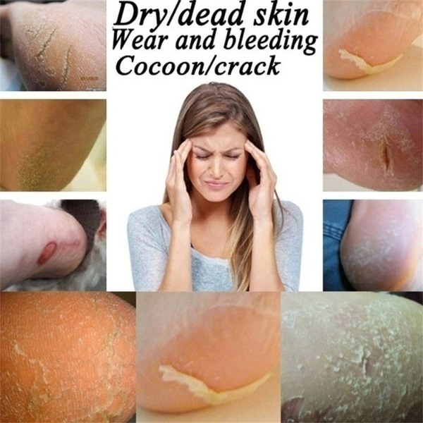 Set 2 chiếc vớ silicon bảo vệ gót chân