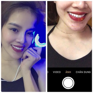 [Sốc] Máy tẩy trắng răng Nhật Bản